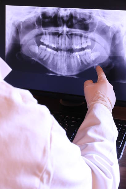 Best Dental Abscess Treatment in Indian River Shores, FL